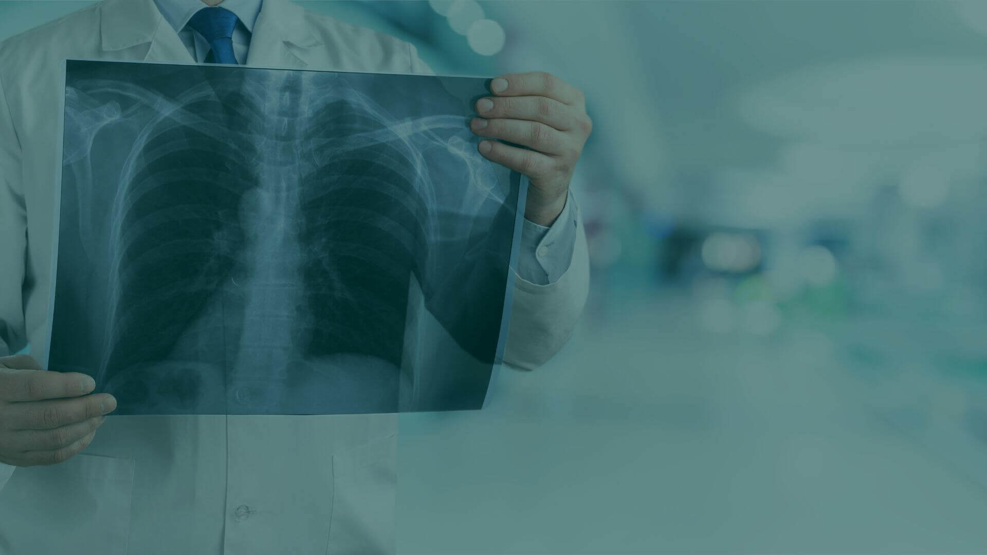 Research Overview: Cardiac Comorbidity and Radiation-Induced Lung Toxicity (RILT)